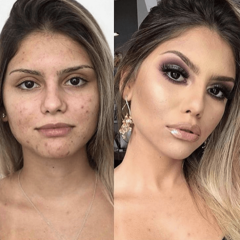 Image Title My Image